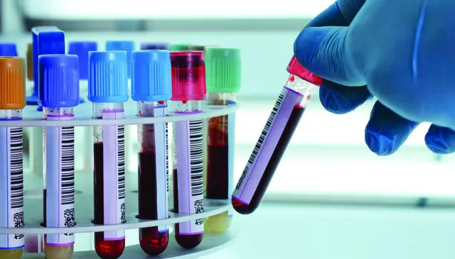 sangre-laboratorio