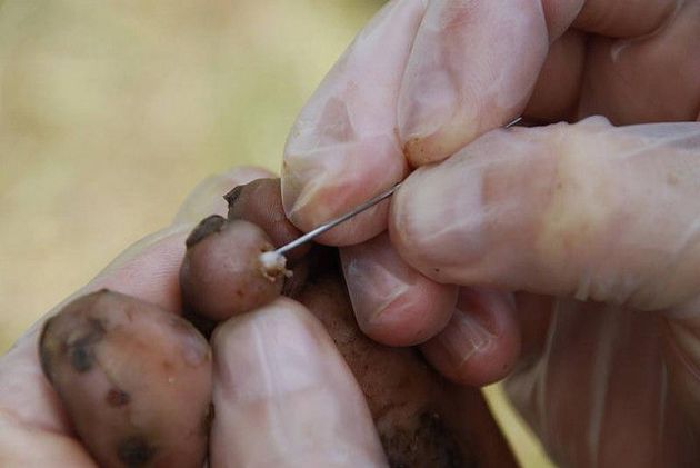 Las cinco enfermedades de la piel más extrañas del mundo 4 #5 Tungiasis