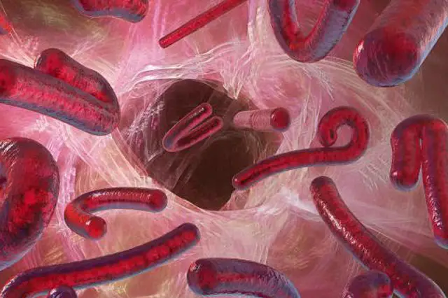6 ideas falsas que se tienen sobre el virus del Ébola