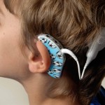 implante coclear eduacion sordo