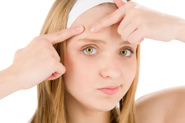 acne salud acne salud