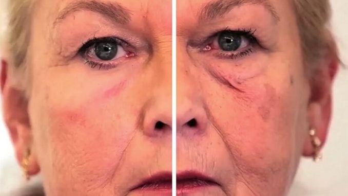 Crean una piel artificial que rejuvenece temporalmente Crean una piel artificial que rejuvenece temporalmente