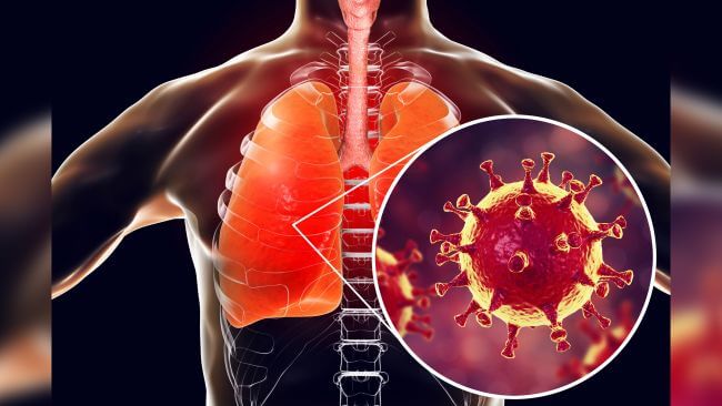 Coronavirus
