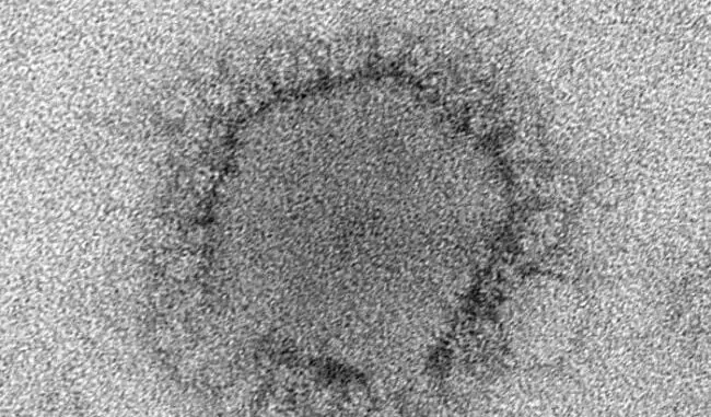 Nuevo Coronavirus Nuevo Coronavirus